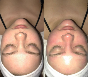 oxygeneo scottsdale az inspire day spa