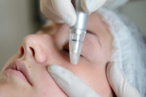5 Key Benefits of Hydrafacials | Phoenix | Inspire Day Spa