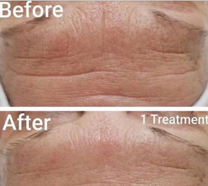 Benefits of OxyGeneo | Facials Phoenix | Inspire Day Spa